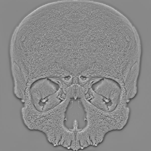 A Skull test